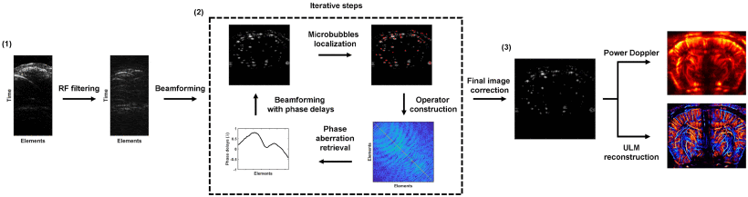 New publication: Inverse Problem Approach to Aberration Correction for In Vivo Transcranial Imaging Based on a Sparse Representation of Contrast-Enhanced Ultrasound Data