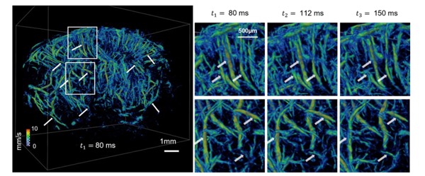 New publication: 3D transcranial Dynamic Ultrasound Localization Microscopy in the mouse brain using a Row-Column Array