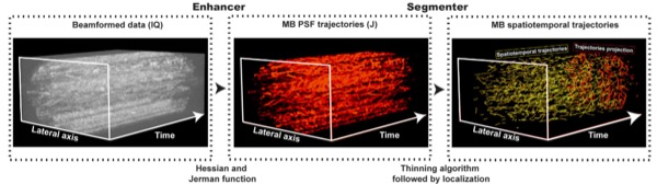 New publication: A Tracking Prior to Localization Workflow for Ultrasound Localization Microscopy