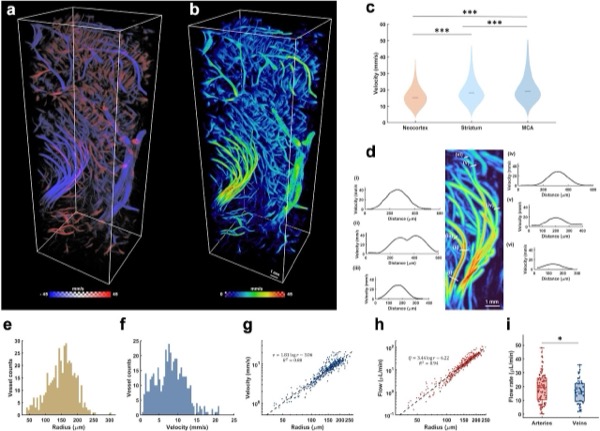 New publication: 3D ultrasound localization microscopy of the nonhuman primate brain