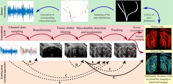 New publication: Deep Learning in Ultrasound Localization Microscopy: Applications and Perspectives