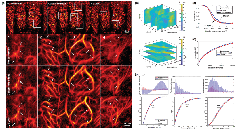 New publication: Phase Aberration Correction for In Vivo Ultrasound Localization Microscopy Using a Spatiotemporal Complex-Valued Neural Network