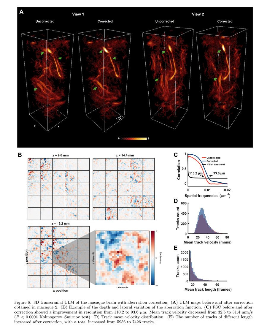 New preprint: Automatic Aberration Correction for Transcranial Functional and Super-Resolution Ultrasound Imaging in Rodents and Nonhuman Primates