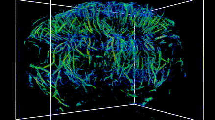 3D imaging