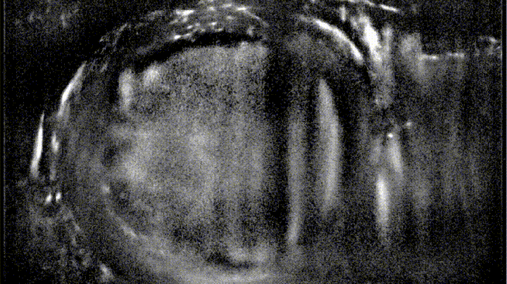 Myocardial ultrasound localization angiography