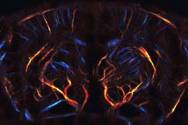 Pulsatility Imaging